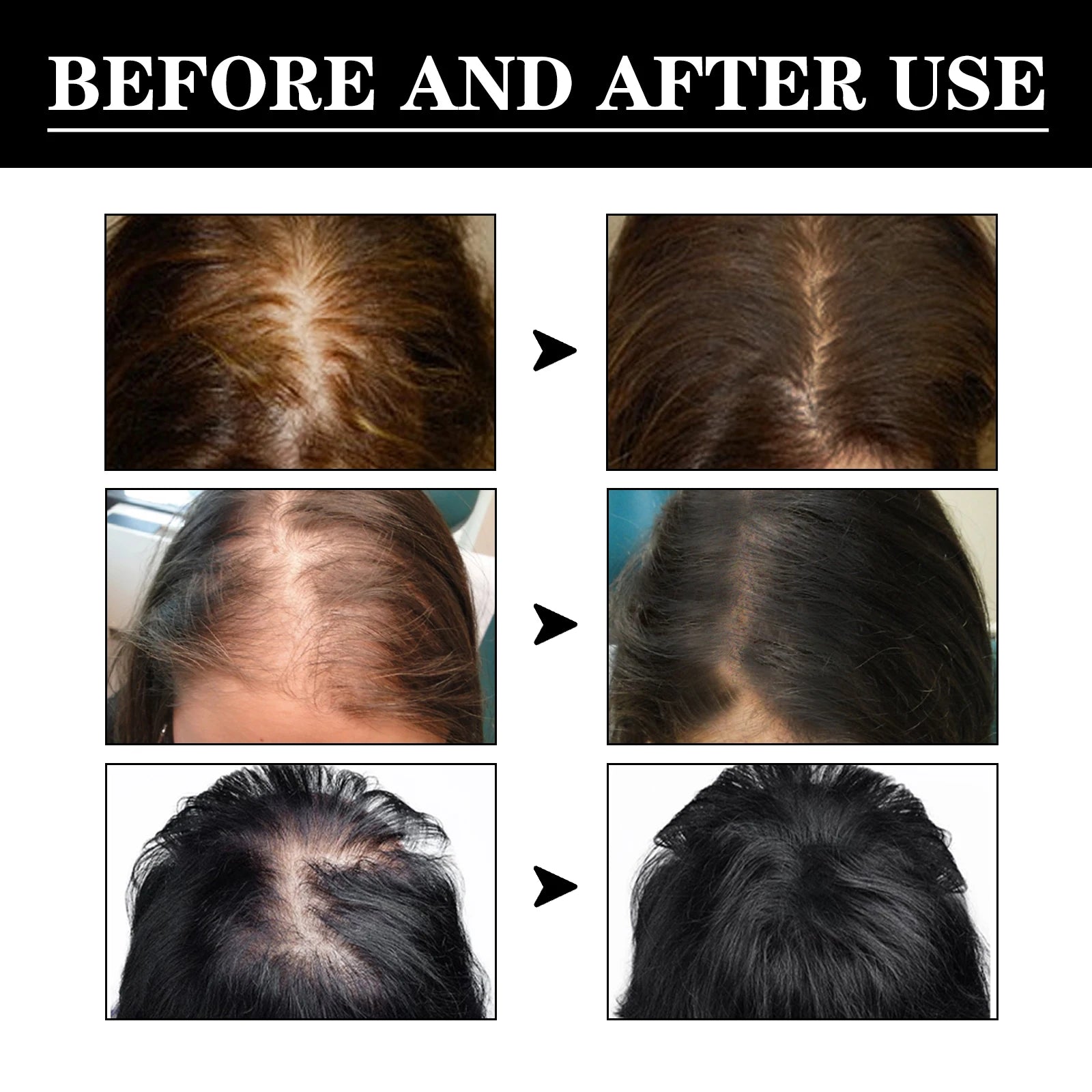 Scalp Nourishment & Hair Growth Strengthening Serum