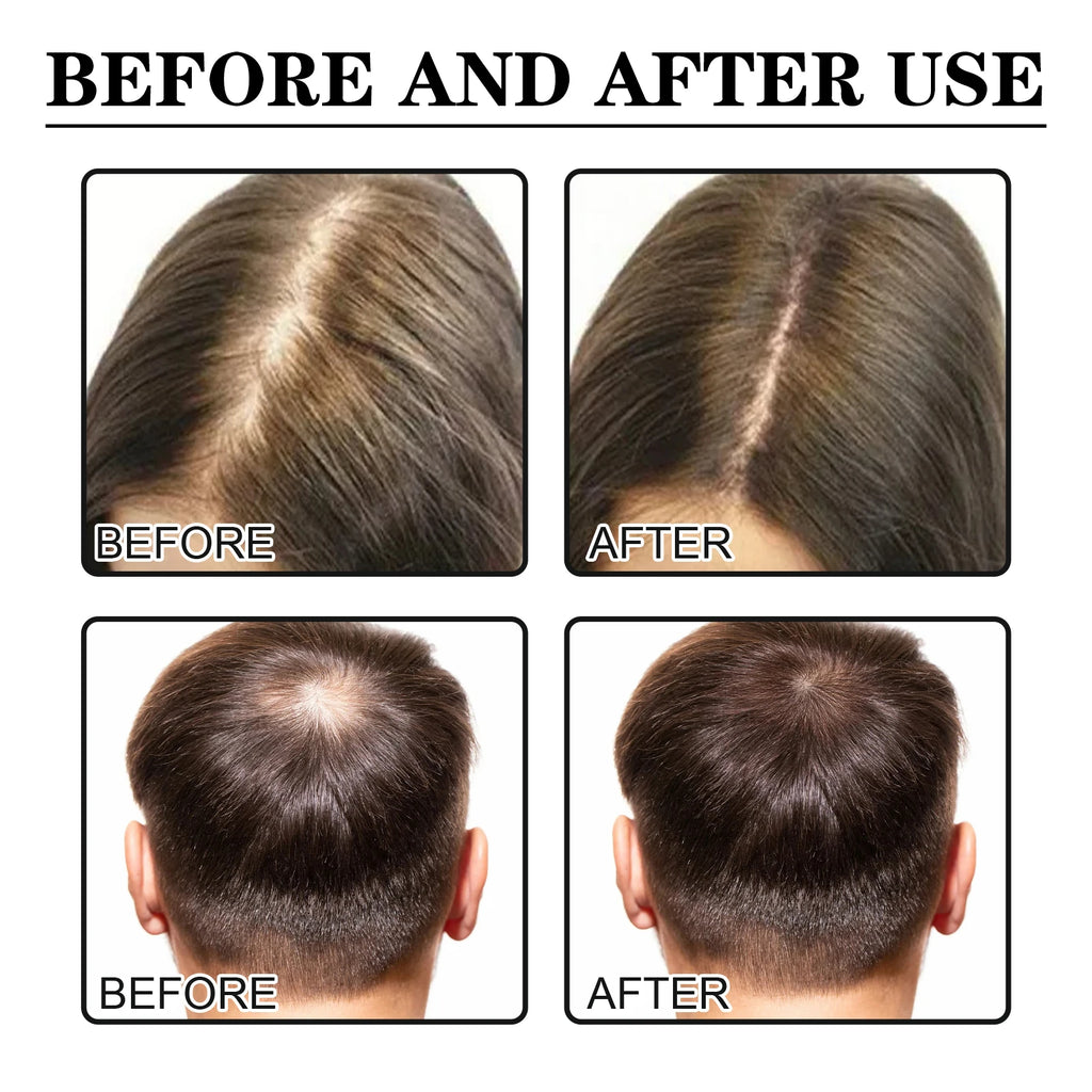 Scalp Nourishment & Hair Growth Strengthening Serum